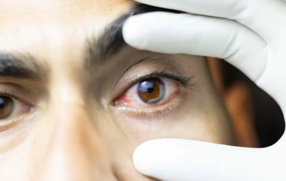 शरीर की बीमारियों के संकेत आंखों में