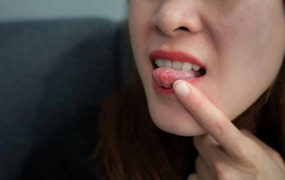 मुंह के न भरने वाले घाव ओरल कैंसर का संकेत…