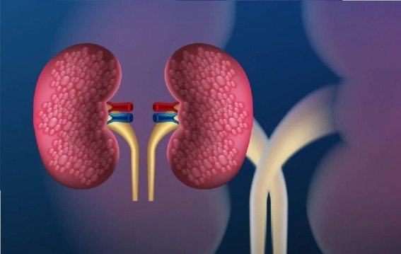 किडनी से जुड़ी समस्याओं में राहत के उपाय