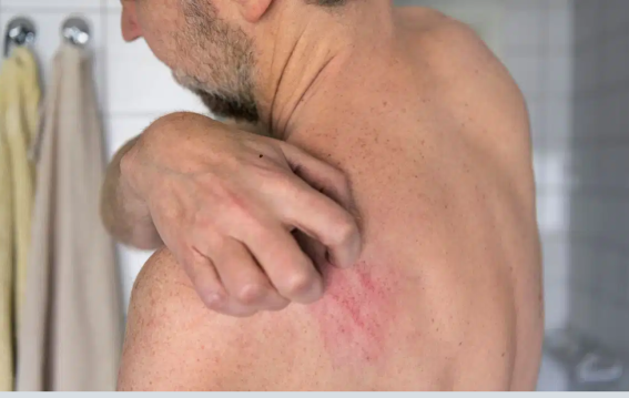 पीठ-पैरों की खुजली से राहत कैसे? जानें असरदार उपाय