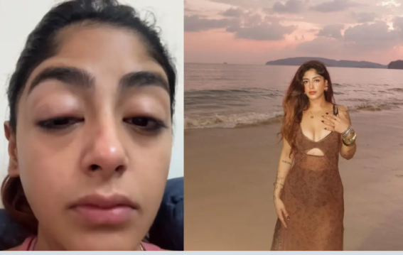 Splitsvilla स्टार पर हमला!