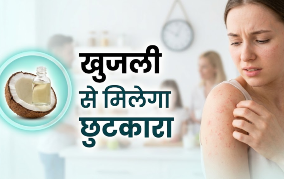गर्मी की खुजली-दाने से छुटकारा