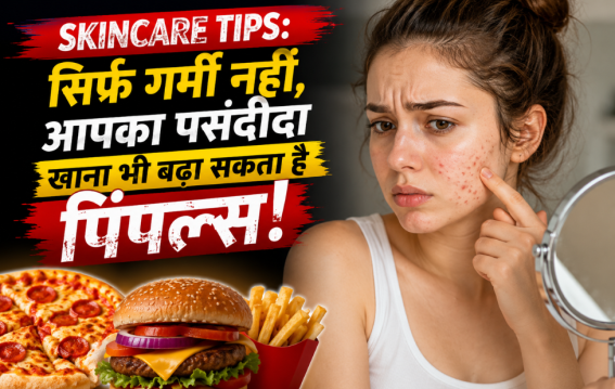 सिर्फ गर्मी नहीं, आपका पसंदीदा खाना भी बढ़ा सकता है पिंपल्स!
