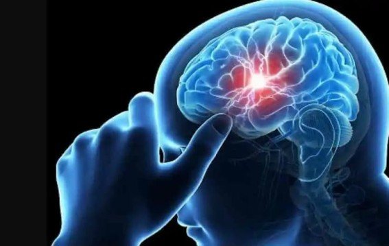 Brain Stroke Symptoms: ब्रेन स्ट्रोक के 5 संकेत