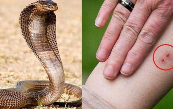 सांप ने काटा? तुरंत करें ये काम