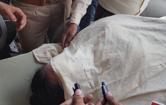 शादी से पहले क्यों हुआ शिक्षिका पर एसिड अटैक